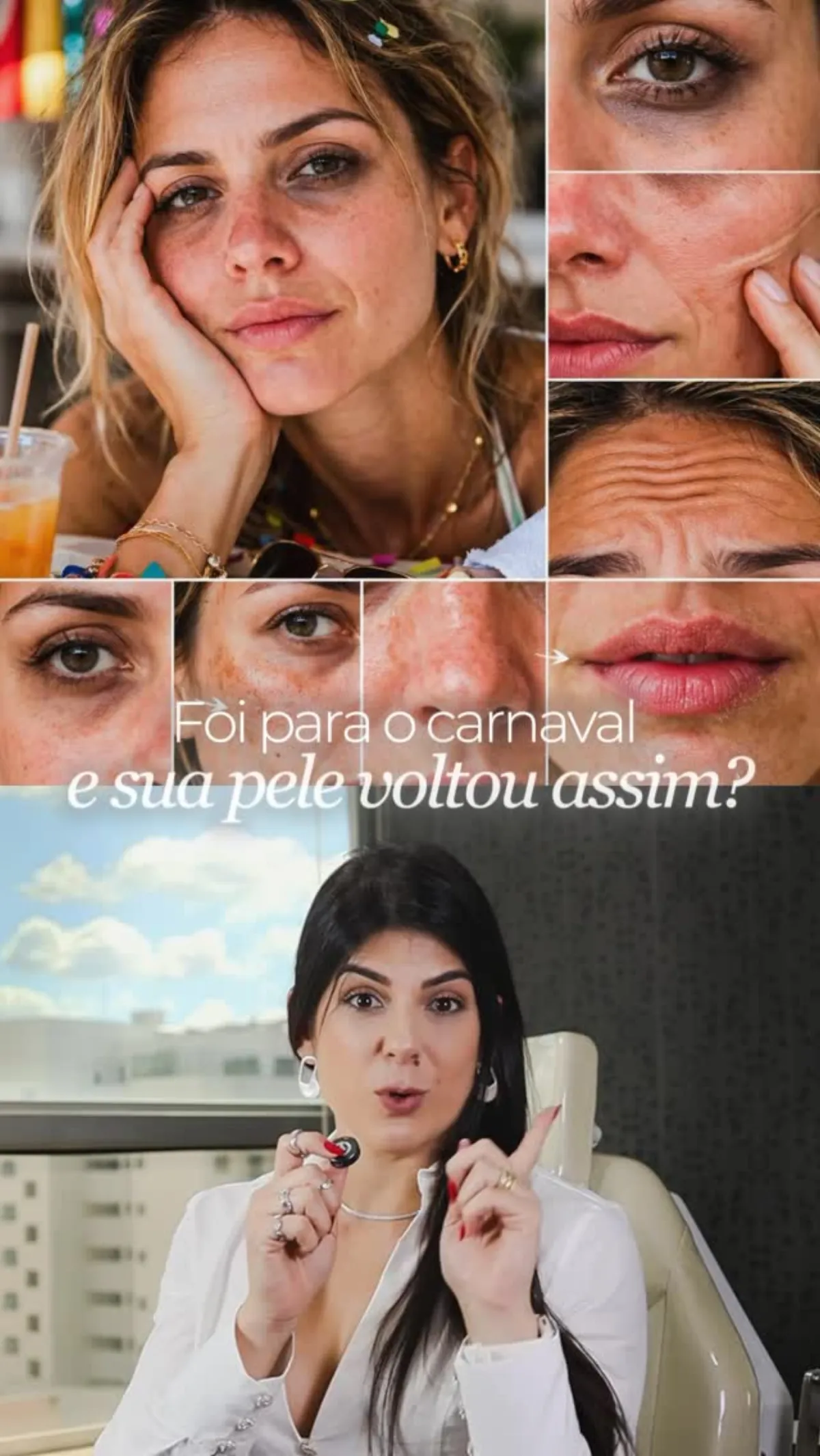 Olheiras, sulcos e desidratação